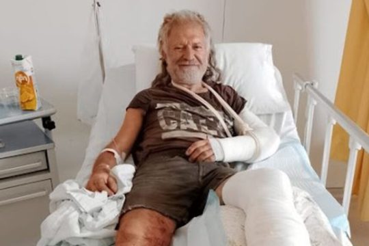 Ο Μανώλης Χριστουδουλάκης στο νοσοκομείο με πολλαπλά κατάγματα
